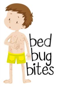 bed bugs bite